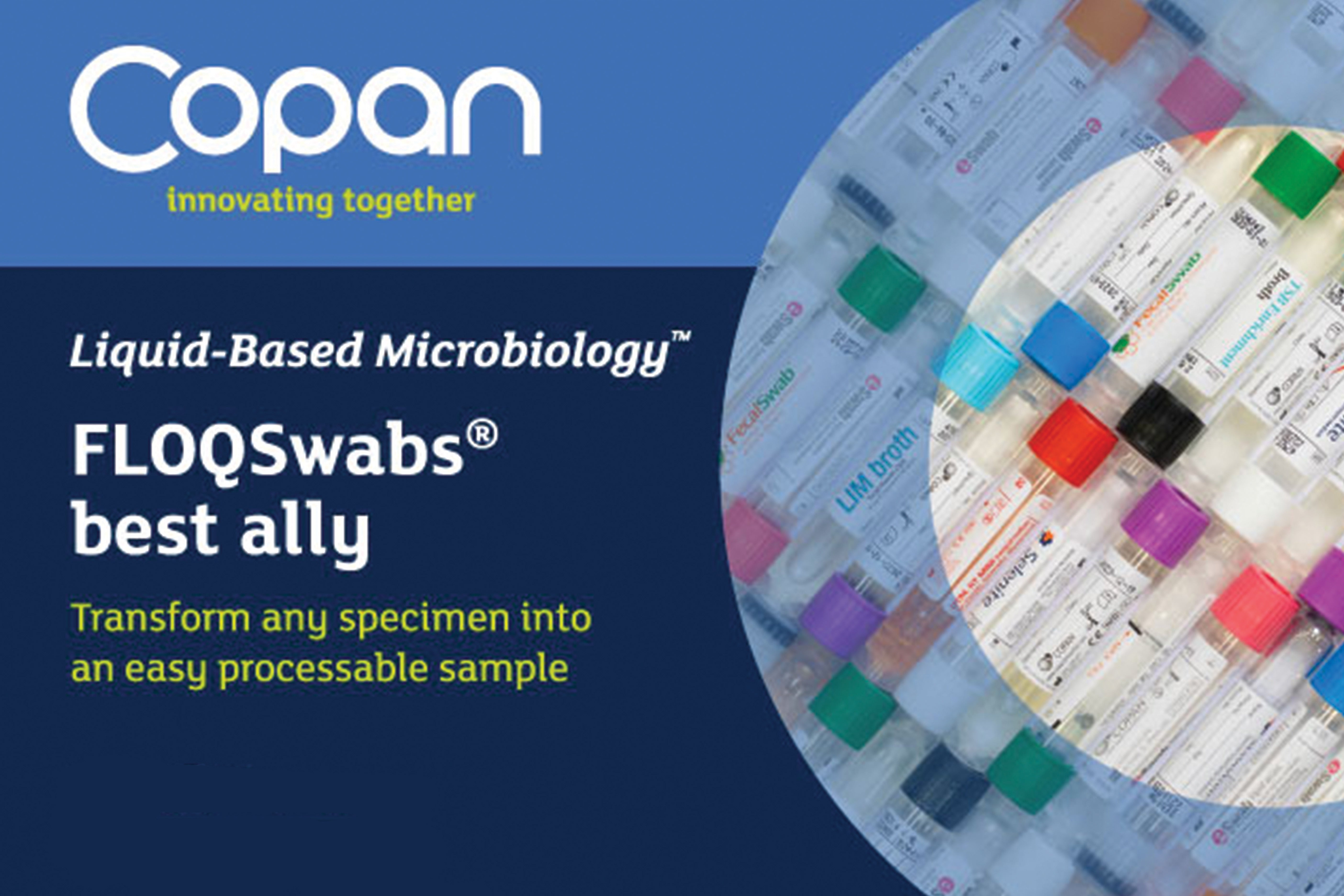 Scientific Insights: Copan FLOQSwabs® Yield Superior Flu Diagnostics and Minimal Discomfort